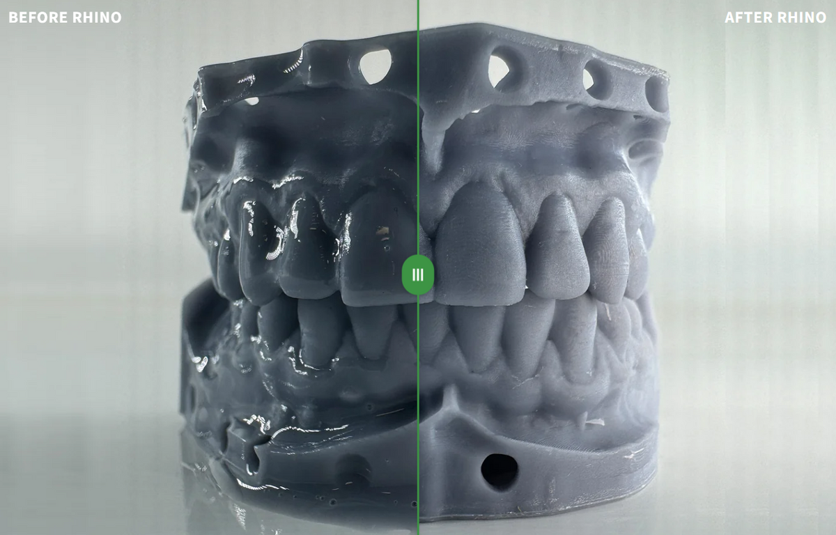 Before and after rinsing comparison of a printed dental model cleaned with Rhino Resin Cleaner